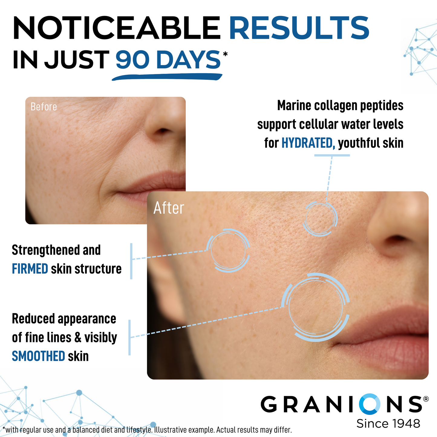 Advertisement for GRANIONS skin care product showing before and after effects on skin.
